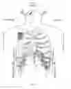 Fig. 22 - Obstructive sleep apnea treatment devices, systems and methods