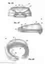 Fig. 06 - REINFORCED POLYMER CUFF HORSESHOE