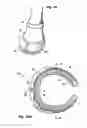 Fig. 08 - REINFORCED POLYMER CUFF HORSESHOE
