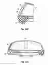 Fig. 09 - REINFORCED POLYMER CUFF HORSESHOE
