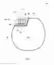 Fig. 02 - Head part for an implantable medical device