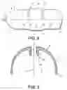 Fig. 03 - Gas cylinder