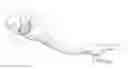 Fig. 01 - Surgical Stapling Instrument