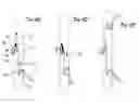 Fig. 09 - Fluid delivery system for personal mobility devices