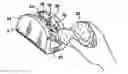 Fig. 01 - Total knee joint mold and methods