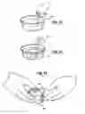 Fig. 06 - Total knee joint mold and methods