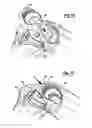 Fig. 08 - Total knee joint mold and methods