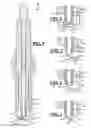 Fig. 02 - Electrode material for a spark plug