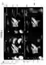 Fig. 07 - System for suppression of artifacts in MR imaging