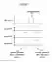 Fig. 08 - System for suppression of artifacts in MR imaging