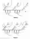 Fig. 03 - SIMULTANEOUS PHASE AND AMPLITUDE CONTROL USING TRIPLE STUB TOPOLOGY AND ITS IMPLEMENTATION USING RF MEMS TECHNOLOGY