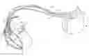 Fig. 01 - ACCELEROMETER FEEDBACK CONTROL LOOP FOR PATIENT ALERT