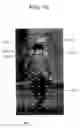 Fig. 11 - Information processing device and method for recognition of target objects within an image