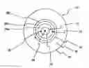 Fig. 01 - Contact lens sets and methods to prevent or slow progression of myopia or hyperopia