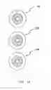 Fig. 06 - Contact lens sets and methods to prevent or slow progression of myopia or hyperopia
