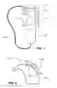 Fig. 02 - STAND-ALONE MICROPHONE TEST HOUSING FOR A HEARING DEVICE
