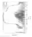 Fig. 06 - Echo suppression for wireless handsets and headsets