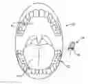 Fig. 01 - Tinnitus masking systems
