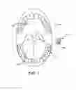 Fig. 02 - Tinnitus masking systems