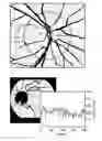 Fig. 01 - Method, apparatus, and system for retinal image analysis
