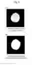 Fig. 05 - Medical image display processing method, device, and program