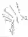 Fig. 05 - STIFFENING SYSTEM FOR STEAM TURBINE CASING