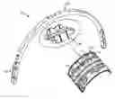 Fig. 01 - Gas turbine engine synchronizing ring bumper