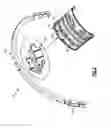 Fig. 03 - Gas turbine engine synchronizing ring bumper
