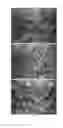 Fig. 03 - MAGNESIUM-ALUMINUM BASED ALLOY