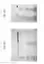 Fig. 22 - Carrier immunoglobulins