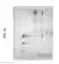 Fig. 40 - Carrier immunoglobulins