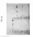 Fig. 46 - Carrier immunoglobulins
