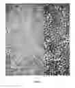 Fig. 02 - Agent for protection of tooth surfaces, in conjunction with conventional bleaching methods, by biomimetic deposition of fluorapatite