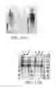 Fig. 10 - Method of producing a lipolytic enzyme