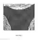 Fig. 05 - Composite metal foam and methods of preparation thereof