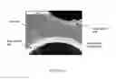 Fig. 10 - Composite metal foam and methods of preparation thereof