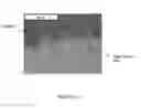 Fig. 11 - Composite metal foam and methods of preparation thereof