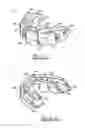 Fig. 02 - Orthodontic appliance
