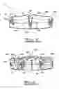 Fig. 03 - Orthodontic appliance