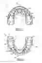 Fig. 04 - Orthodontic appliance
