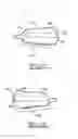 Fig. 05 - Orthodontic appliance
