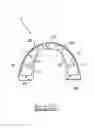 Fig. 08 - Orthodontic appliance