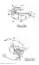Fig. 09 - Orthodontic appliance
