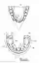 Fig. 11 - Orthodontic appliance
