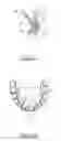 Fig. 12 - Orthodontic appliance