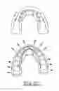 Fig. 14 - Orthodontic appliance