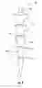 Fig. 05 - Endodontic instrument and method