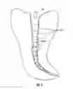 Fig. 07 - Endodontic instrument and method
