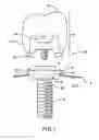 Fig. 02 - Angled dental platform assembly and methods