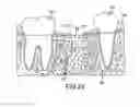 Fig. 22 - Angled dental platform assembly and methods